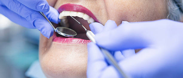 Best Broken or Chipped Tooth Repair in Mooresville, NC